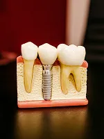 طب الأسنان